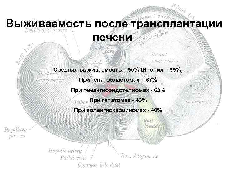  Выживаемость после трансплантации печени Средняя выживаемость – 90% (Япония – 99%) При гепатобластомах