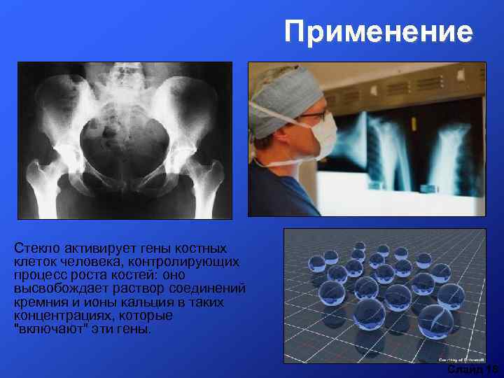 Применение Стекло активирует гены костных клеток человека, контролирующих процесс роста костей: оно высвобождает раствор