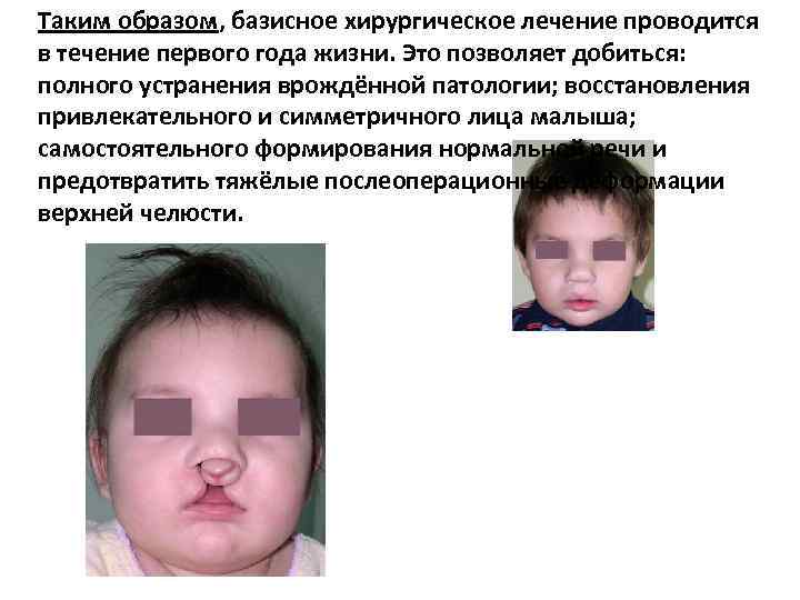 Таким образом, базисное хирургическое лечение проводится в течение первого года жизни. Это позволяет добиться: