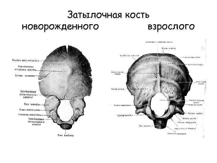 Наружный затылочный выступ