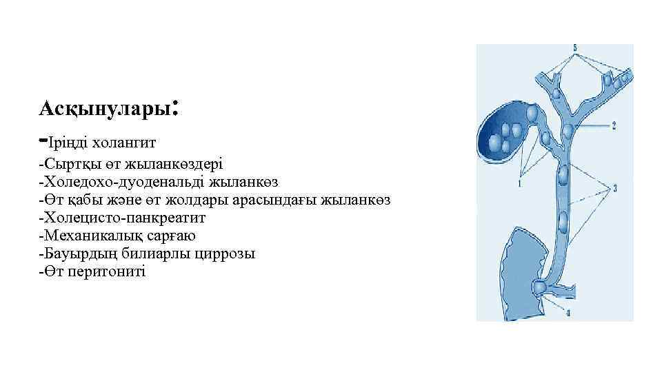 Асқынулары: -Іріңді холангит -Сыртқы өт жыланкөздері -Холедохо-дуоденальді жыланкөз -Өт қабы және өт жолдары арасындағы