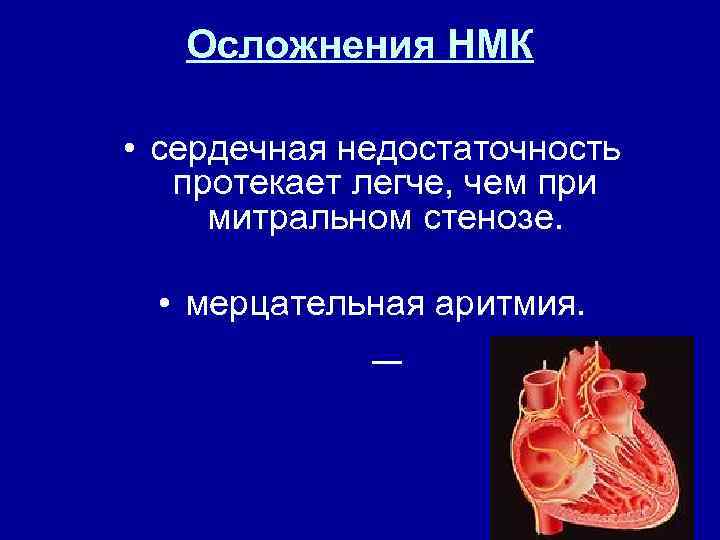 Осложнения НМК • сердечная недостаточность протекает легче, чем при митральном стенозе. • мерцательная аритмия.