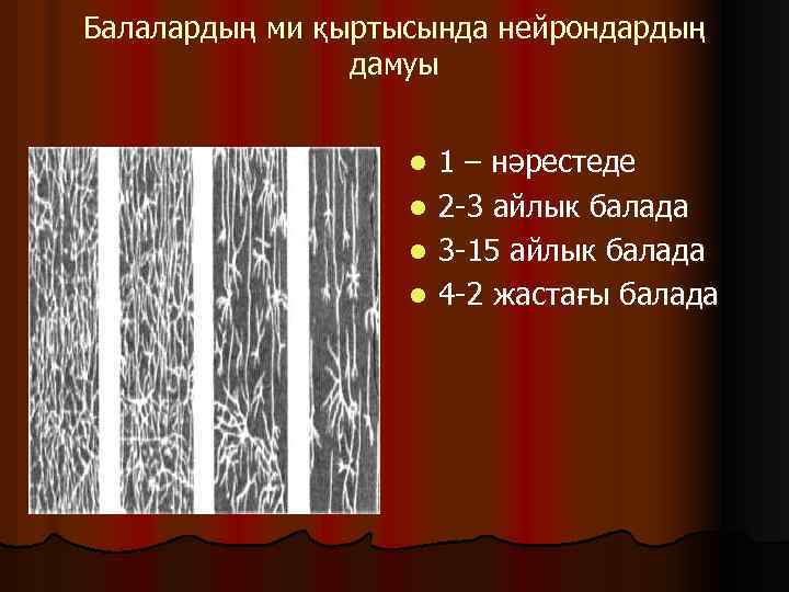 Балалардың ми қыртысында нейрондардың дамуы 1 – нәрестеде l 2 -3 айлык балада l