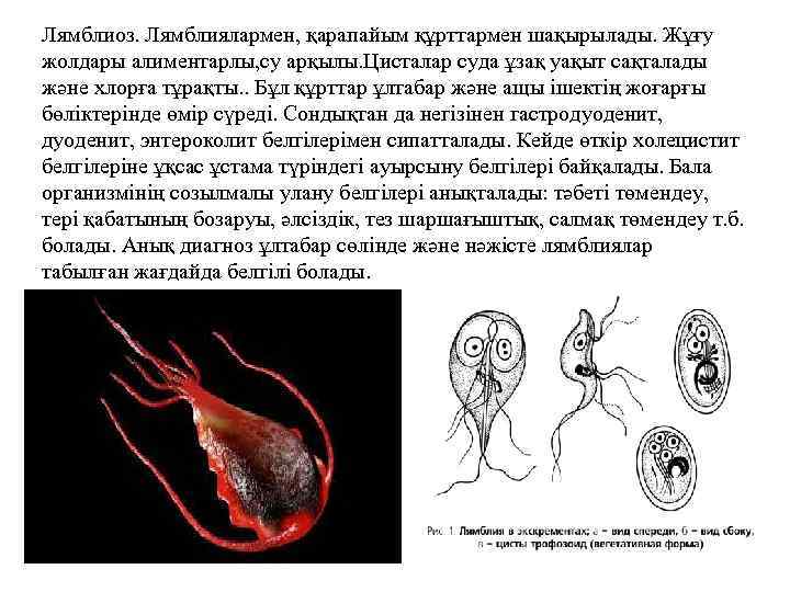 Лямблиоз. Лямблиялармен, қарапайым құрттармен шақырылады. Жұғу жолдары алиментарлы, су арқылы. Цисталар суда ұзақ уақыт