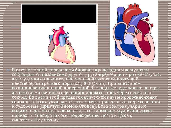  В случае полной поперечной блокады предсердия и желудочки сокращаются независимо друг от друга-предсердия