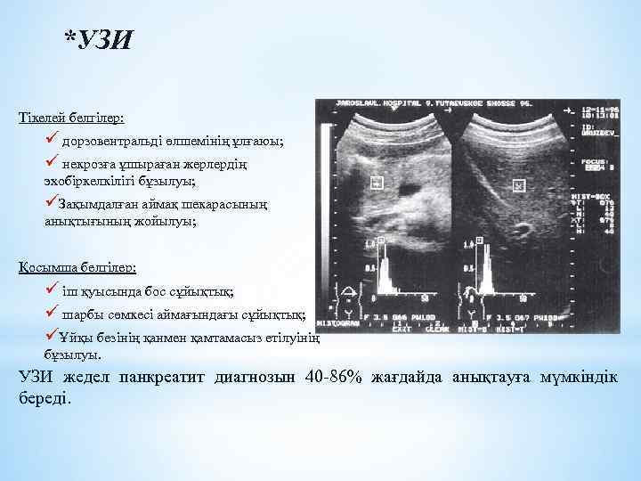 *УЗИ Тікелей белгілер: ü дорзовентральді өлшемінің ұлғаюы; ü некрозға ұшыраған жерлердің эхобіркелкілігі бұзылуы; üЗақымдалған