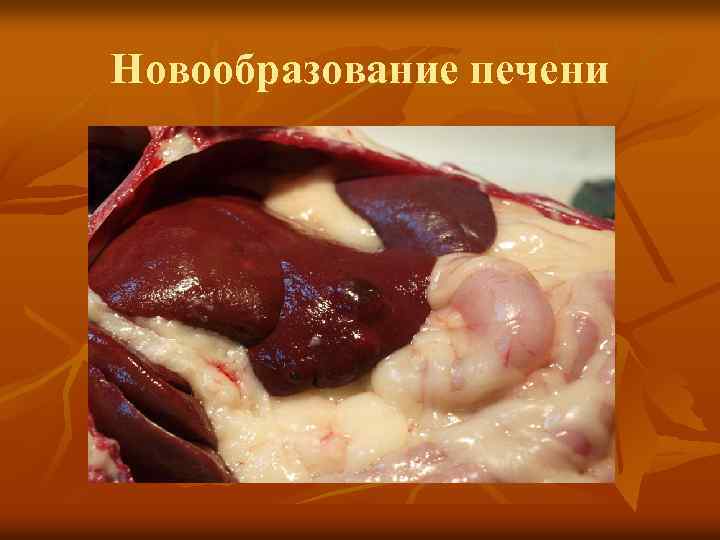Новообразование печени 
