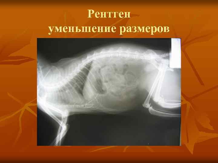 Рентген уменьшение размеров 