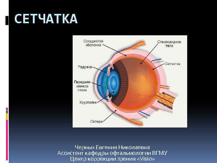 СЕТЧАТКА Черных Евгения Николаевна Ассистент кафедры офтальмологии ВГМУ Центр коррекции зрения «Visio» 