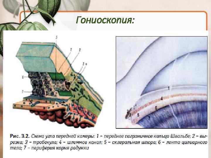 Гониоскопия: 