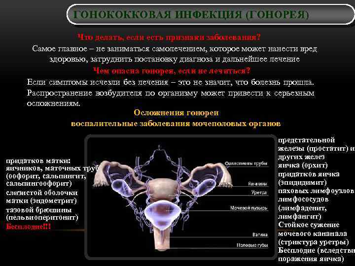 ГОНОКОККОВАЯ ИНФЕКЦИЯ (ГОНОРЕЯ) Что делать, если есть признаки заболевания? Самое главное – не заниматься