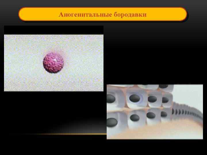 Аногенитальные бородавки 