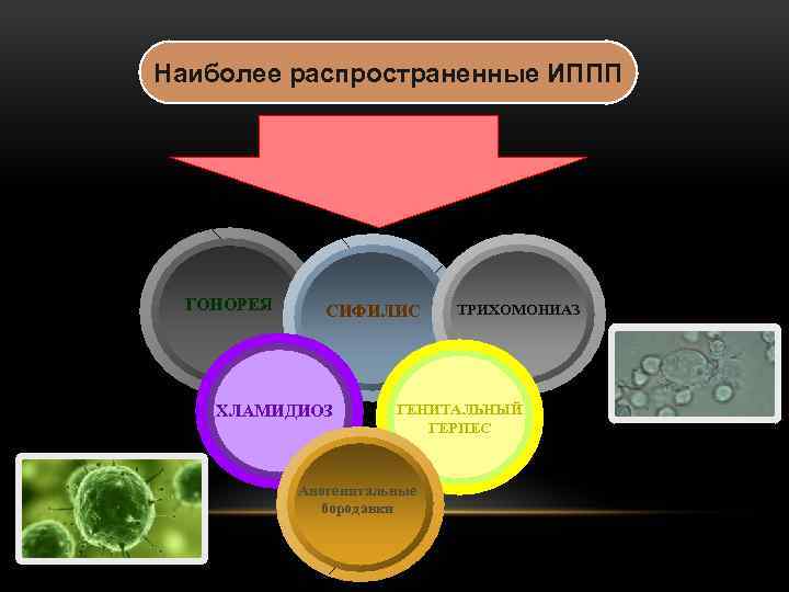 Какие существуют наиболее распространенные иппп