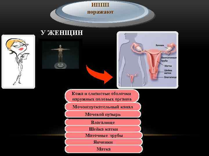 ИППП поражают У ЖЕНЩИН Кожа и слизистые оболочки наружных половых органов Мочеиспускательный канал Мочевой