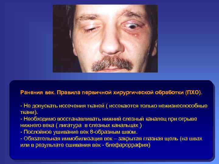 Ранения век. Правила первичной хирургической обработки (ПХО). - Не допускать иссечения тканей ( иссекаются