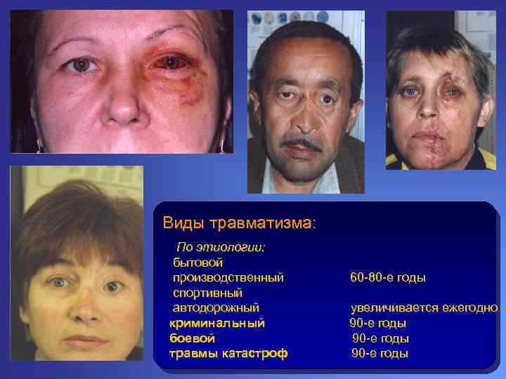 Виды травматизма: По этиологии: бытовой производственный спортивный автодорожный криминальный боевой травмы катастроф 60 -80
