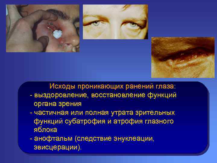 Исходы проникающих ранений глаза: - выздоровление, восстановление функций органа зрения - частичная или полная