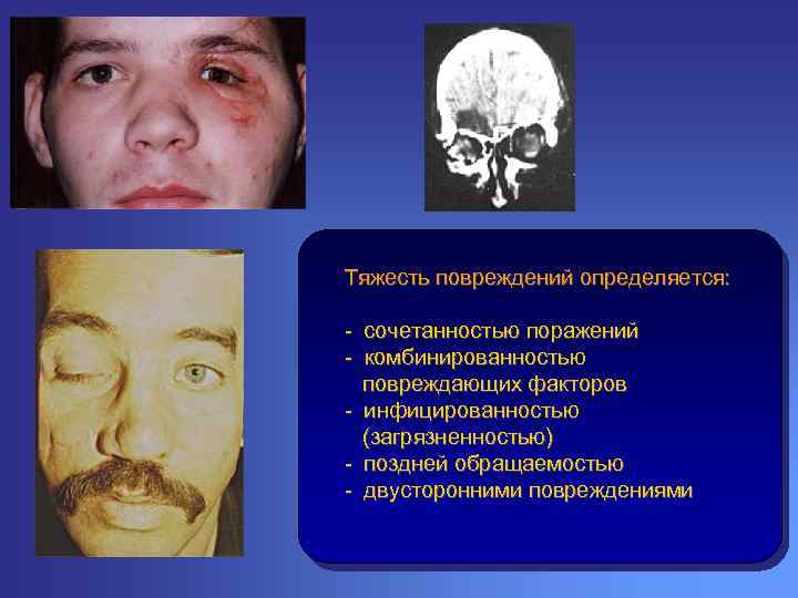 Тяжесть повреждений определяется: - сочетанностью поражений - комбинированностью повреждающих факторов - инфицированностью (загрязненностью) -