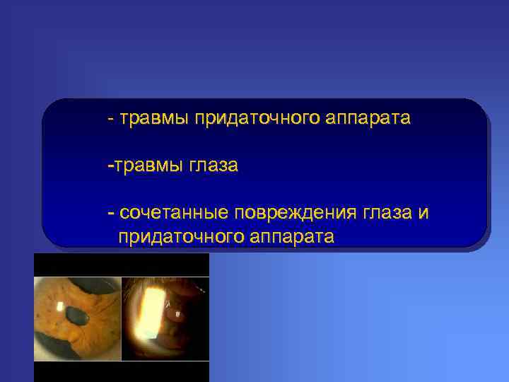 - травмы придаточного аппарата -травмы глаза - сочетанные повреждения глаза и придаточного аппарата 