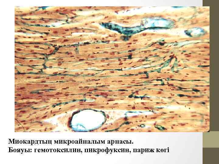 Миокардтың микроайналым арнасы. Бояуы: гемотоксилин, пикрофуксин, париж көгі 