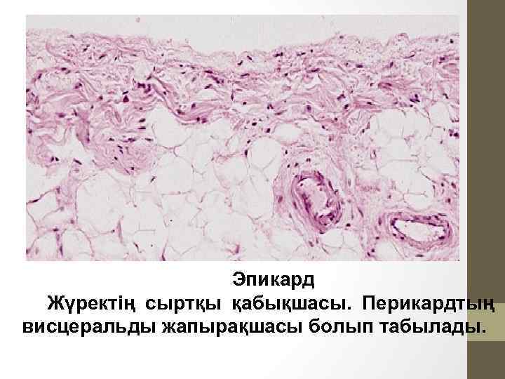 Эпикард Жүректің сыртқы қабықшасы. Перикардтың висцеральды жапырақшасы болып табылады. 