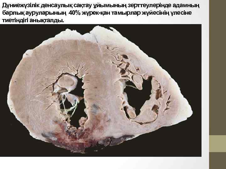 Дүниежүзілік денсаулық сақтау ұйымының зерттеулерінде адамның барлық ауруларының 40% жүрек-қан тамырлар жүйесінің үлесіне тиетіндігі