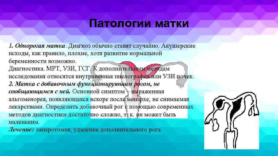 Патологии матки 1. Однорогая матка. Диагноз обычно ставят случайно. Акушерские исходы, как правило, плохие,