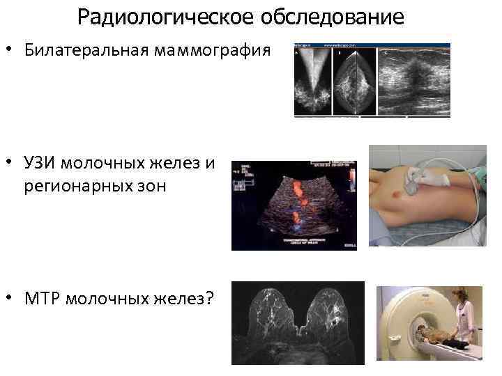 Радиологическое обследование • Билатеральная маммография • УЗИ молочных желез и регионарных зон • МТР
