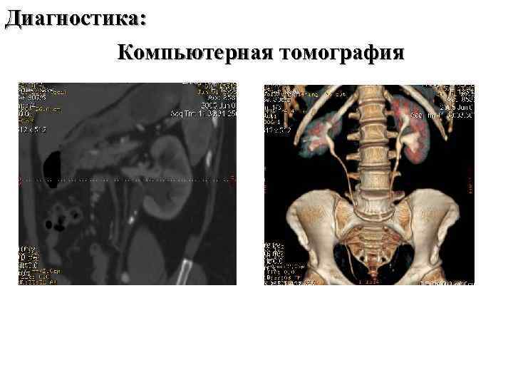 Диагностика: Компьютерная томография 