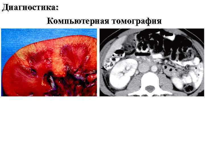 Диагностика: Компьютерная томография 