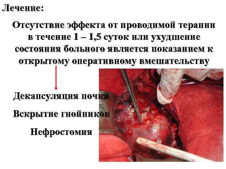 Лечение: Отсутствие эффекта от проводимой терапии в течение 1 – 1, 5 суток или