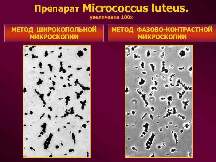 Препарат Micrococcus luteus. увеличение 100 х МЕТОД ШИРОКОПОЛЬНОЙ МИКРОСКОПИИ МЕТОД ФАЗОВО-КОНТРАСТНОЙ МИКРОСКОПИИ 