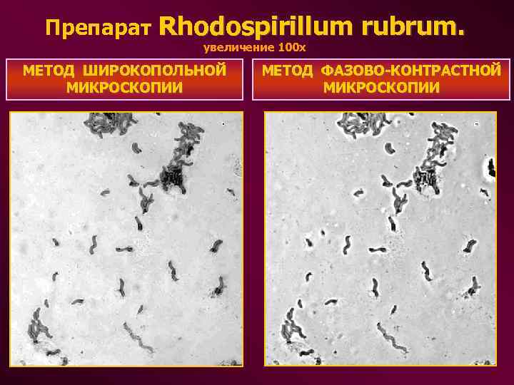 Препарат Rhodospirillum rubrum. увеличение 100 х МЕТОД ШИРОКОПОЛЬНОЙ МИКРОСКОПИИ МЕТОД ФАЗОВО-КОНТРАСТНОЙ МИКРОСКОПИИ 