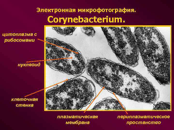 Электронная микрофотография. Corynebacterium. цитоплазма с рибосомами нуклеоид клеточная стенка плазматическая мембрана периплазматическое простанство 