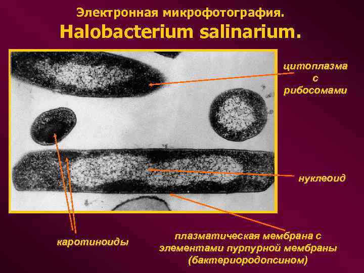 Электронная микрофотография. Halobacterium salinarium. цитоплазма с рибосомами нуклеоид каротиноиды плазматическая мембрана с элементами пурпурной