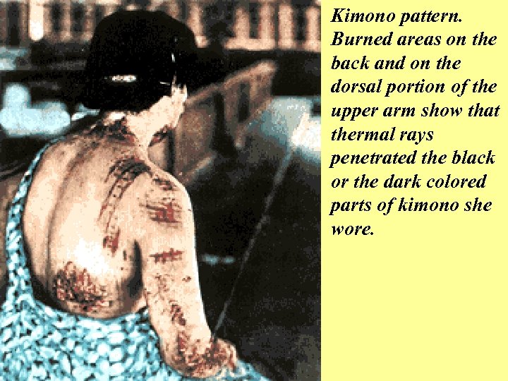 Kimono pattern. Burned areas on the back and on the dorsal portion of the