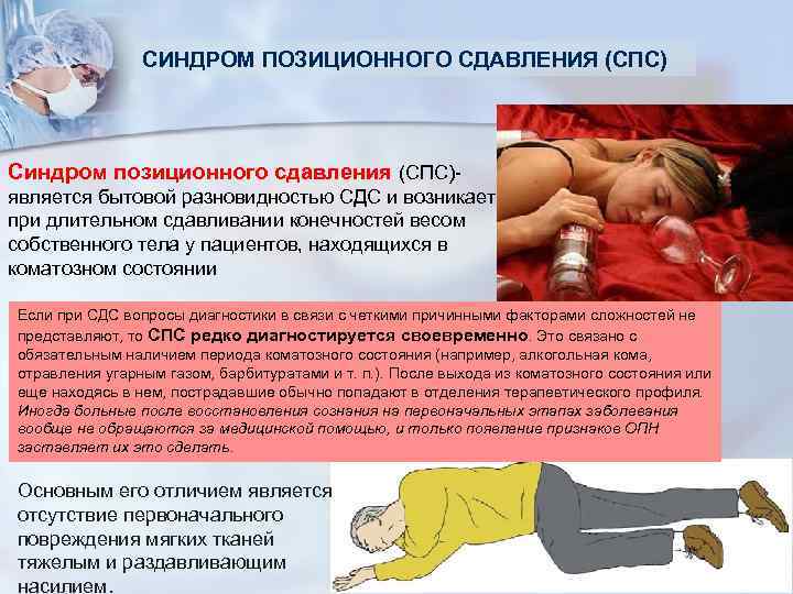 СИНДРОМ ПОЗИЦИОННОГО СДАВЛЕНИЯ (СПС) Синдром позиционного сдавления (СПС)- является бытовой разновидностью СДС и возникает