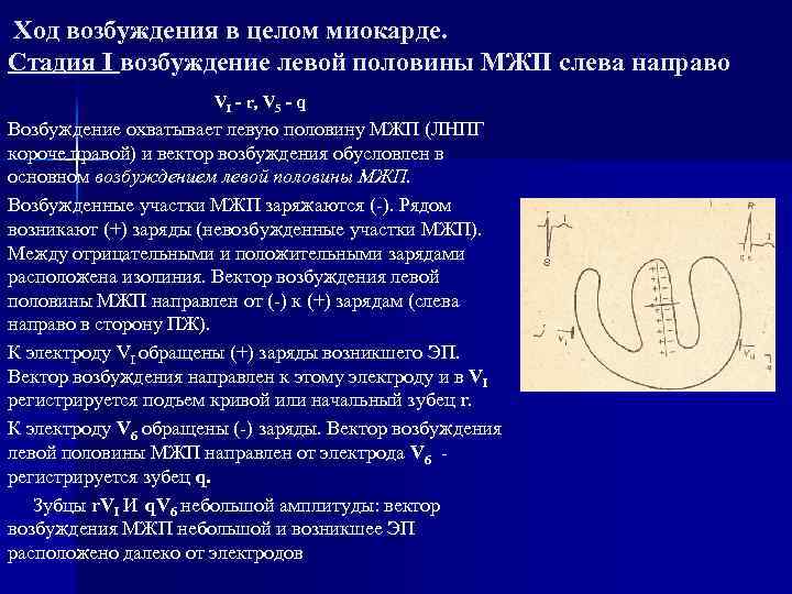 Ход возбуждения в целом миокарде. Стадия I возбуждение левой половины МЖП слева направо VI