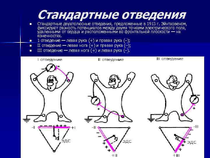 Стандартные отведения n n Стандартные двухполюсные отведения, предложенные в 1913 г. Эйнтховеном, фиксируют разность