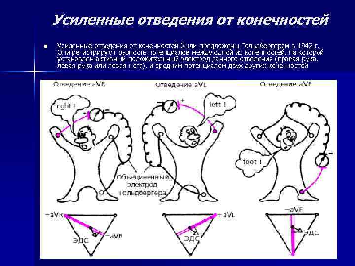 Усиленные отведения от конечностей n Усиленные отведения от конечностей были предложены Гольдбергером в 1942