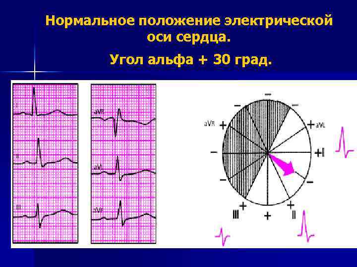 Положение оси сердца