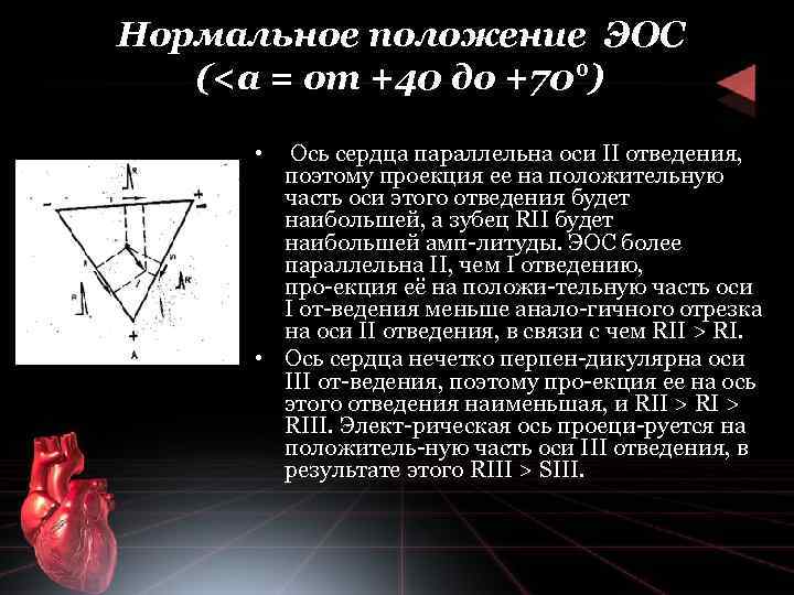 Нормальное положение ЭОС (<а = от +40 до +70°) • Ось сердца параллельна оси