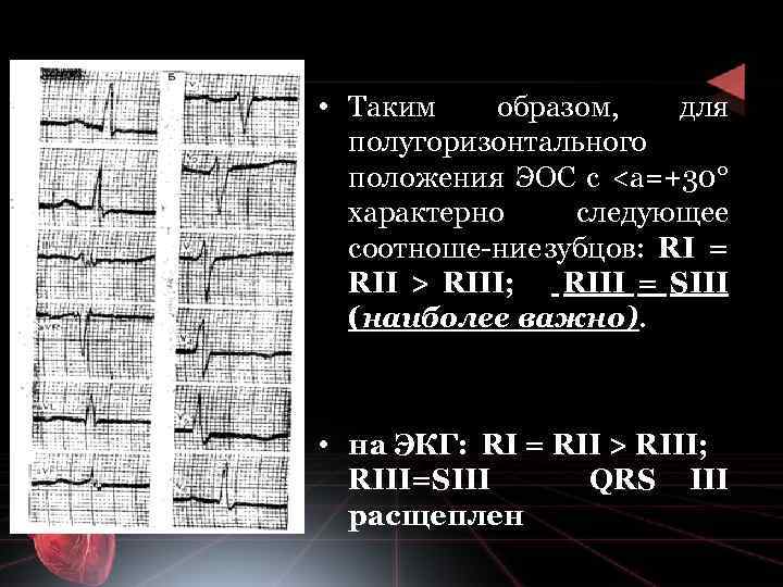  • Таким образом, для полугоризонтального положения ЭОС с <а=+30° характерно следующее соотноше ние