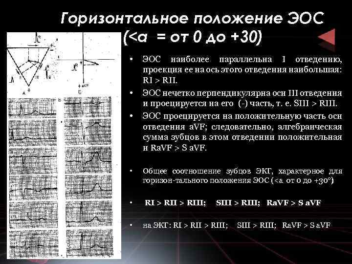 Горизонтальное положение ЭОС (<а = от 0 до +30) • • • ЭОС наиболее