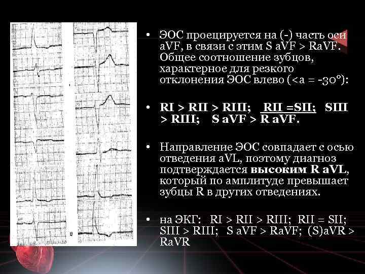  • ЭОС проецируется на ( ) часть оси а. VF, в связи с