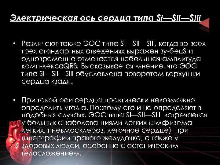  Электрическая ось сердца типа SI—SIII • Различают также ЭОС типа SI—SIII, когда во