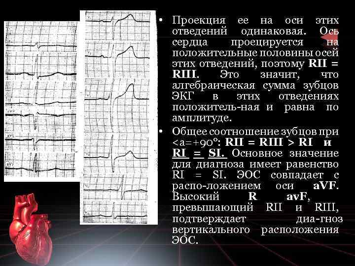  • Проекция ее на оси этих отведений одинаковая. Ось сердца проецируется на положительные