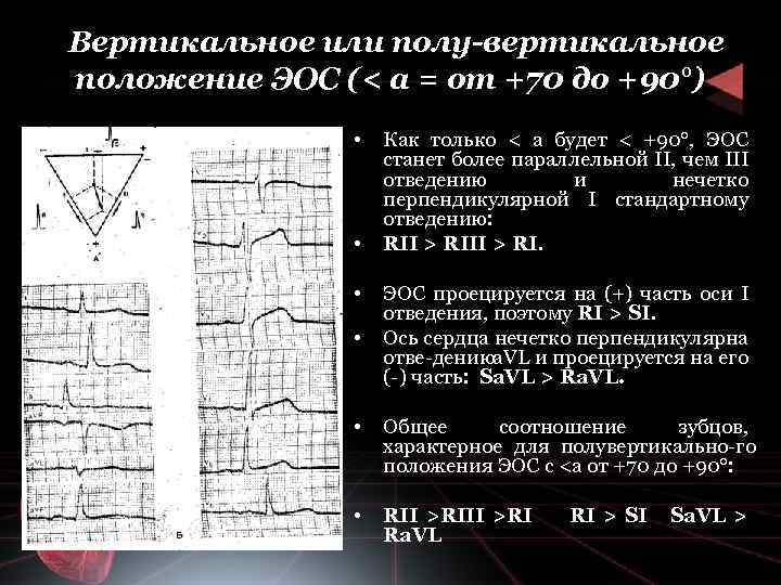 Вертикальное или полу вертикальное положение ЭОС (< а = от +70 до +90°) •