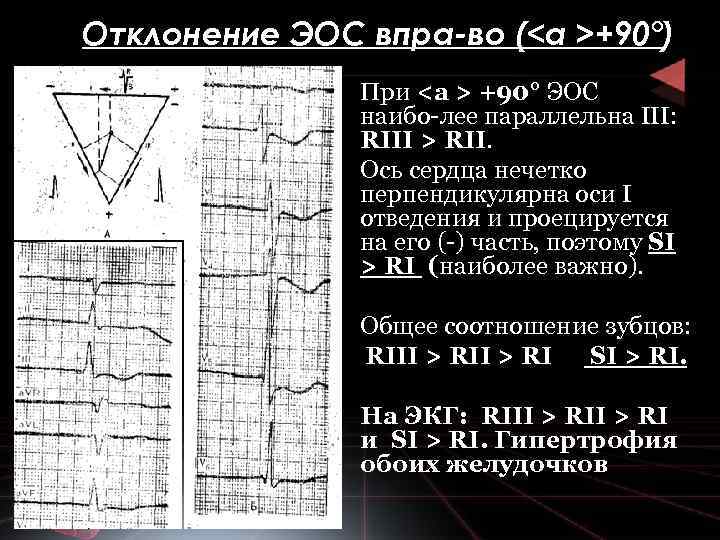 Отклонение ЭОС впра во (<а >+90°) • При <а > +90° ЭОС наибо лее