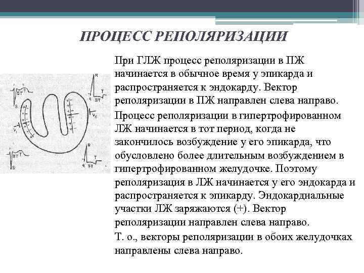 ПРОЦЕСС РЕПОЛЯРИЗАЦИИ При ГЛЖ процесс реполяризации в ПЖ начинается в обычное время у эпикарда